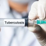 Ogun tuberculosis
