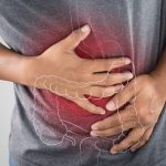 Inflammatory Bowel Disease